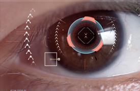 Iris_Biometrics
